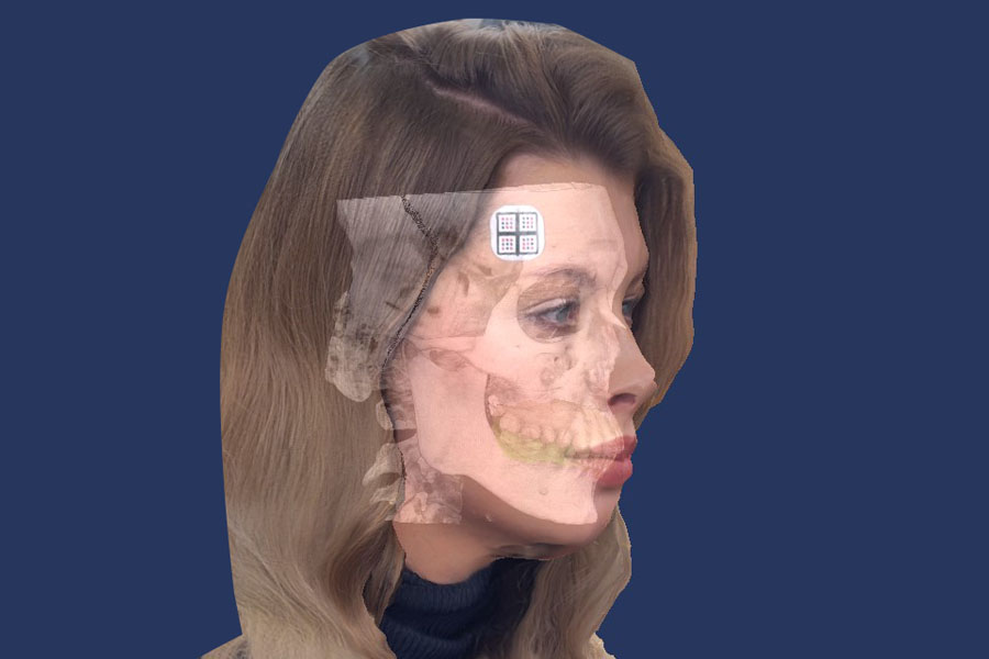 Sdi Matrix Digital Axiograph, including:ProAxis, ProArc, ProStand